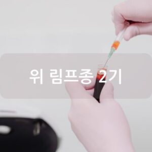 위 림프종 2기