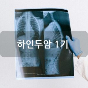 하인두암 1기