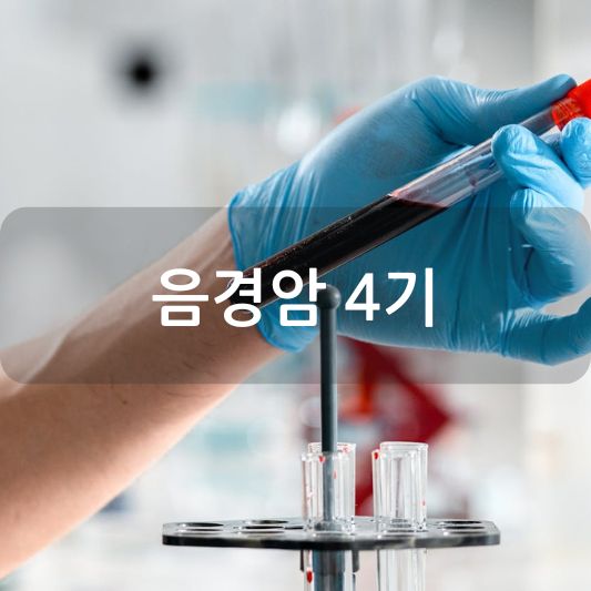 음경암 4기: 원인, 증상, 치료 방법 알아보기!