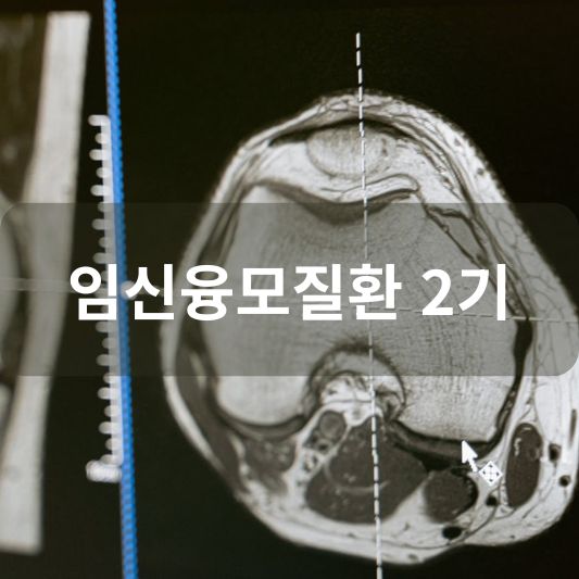 임신융모질환 2기: 원인, 증상, 생존율, 치료 방법 알아보기!