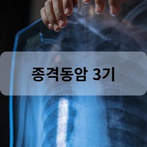 종격동암 3기