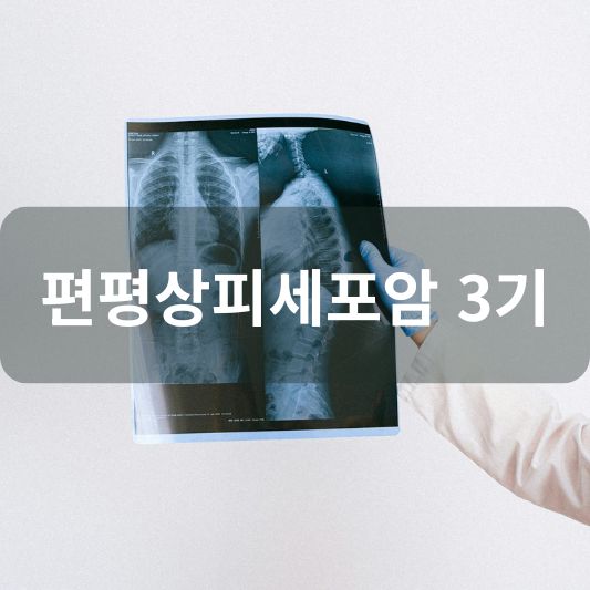 편평상피세포암 3기: 원인, 증상, 치료 방법 알아보기!
