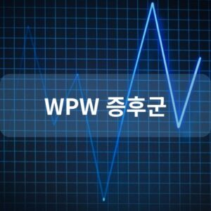 WPW 증후군