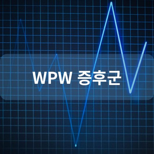 WPW 증후군: 원인, 증상, 치료 방법 알아보기!