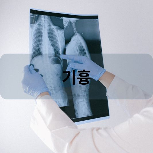 기흉: 원인, 증상, 치료 방법 알아보기!