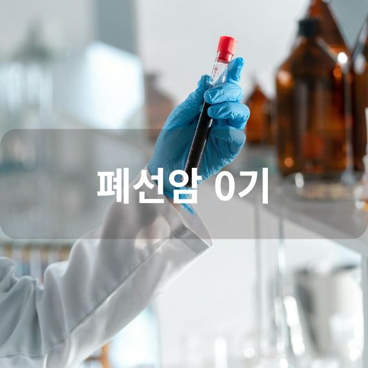 폐선암 0기: 원인, 증상, 치료 방법 알아보기!