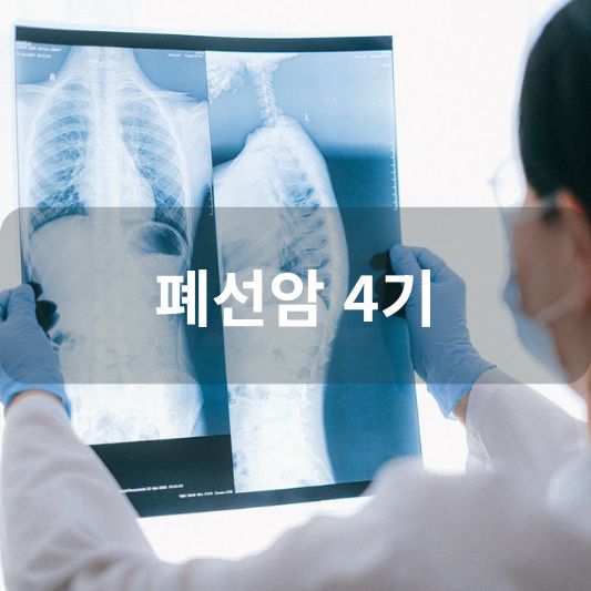 폐선암 4기: 원인, 증상, 치료 방법 알아보기!