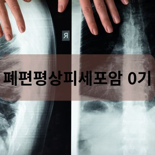 폐편평상피세포암 0기: 원인, 증상, 치료 방법 알아보기!