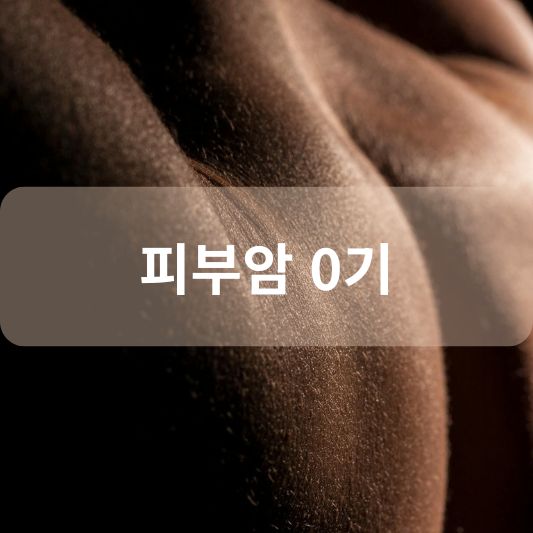 피부암 0기 : 원인, 증상, 치료 방법 알아보기!