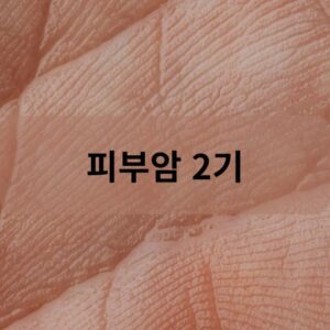 피부암 2기