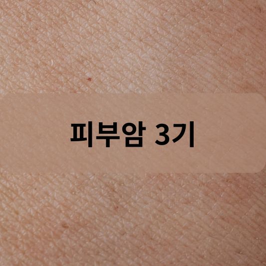 피부암 3기: 원인, 증상, 치료 방법 알아보기!