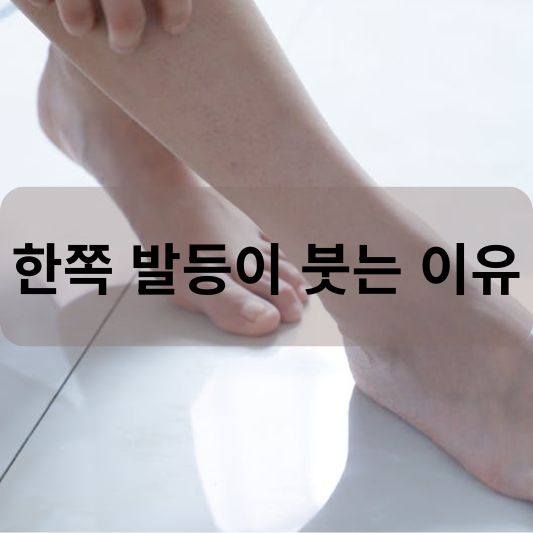 한쪽 발등이 붓는 이유 알아보기!