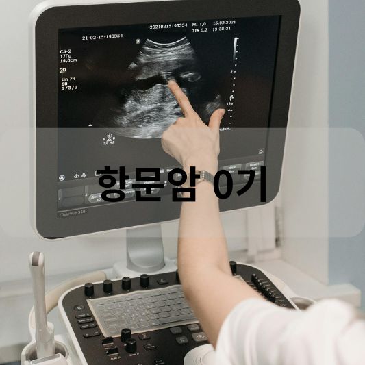 항문암 0기: 원인, 증상, 치료 방법 알아보기!