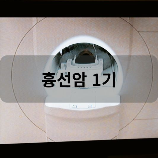 흉선암 1기: 원인, 증상, 치료 방법 알아보기!