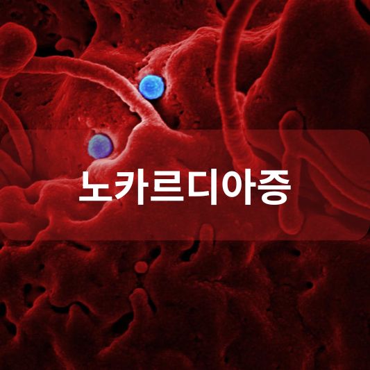 노카르디아증: 원인, 증상, 치료 방법 알아보기!