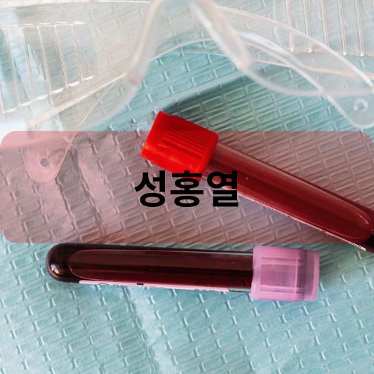 성홍열: 원인, 증상, 격리기간, 치료 방법 알아보기!