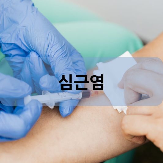 심근염: 원인, 증상, 심전도, 치료 방법 알아보기!