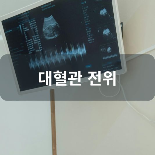 대혈관 전위: 원인, 증상, 치료 방법 알아보기!