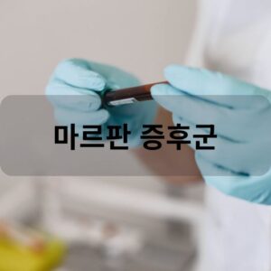 마르판 증후군