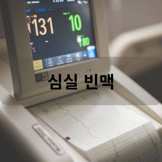 심실 빈맥: 원인, 증상, 치료 방법 알아보기!