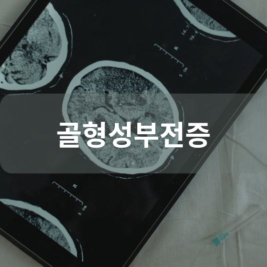 골형성부전증: 원인, 증상, 치료 방법 알아보기!