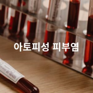 아토피성 피부염