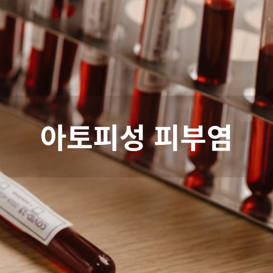 아토피성 피부염: 원인, 증상, 치료 방법 알아보기!