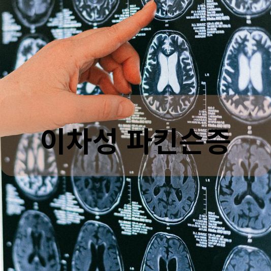 이차성 파킨슨증: 원인, 증상, 치료 방법 알아보기!