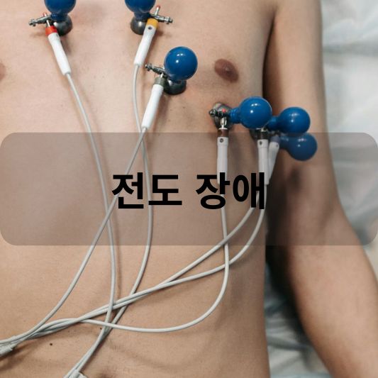 전도 장애: 원인, 증상, 치료 방법 알아보기!