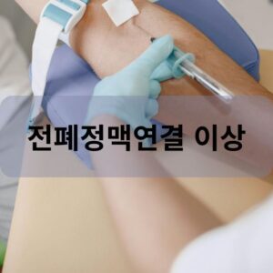 전폐정맥연결 이상