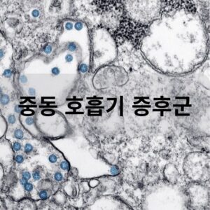 중동 호흡기 증후군