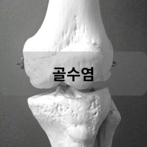 골수염