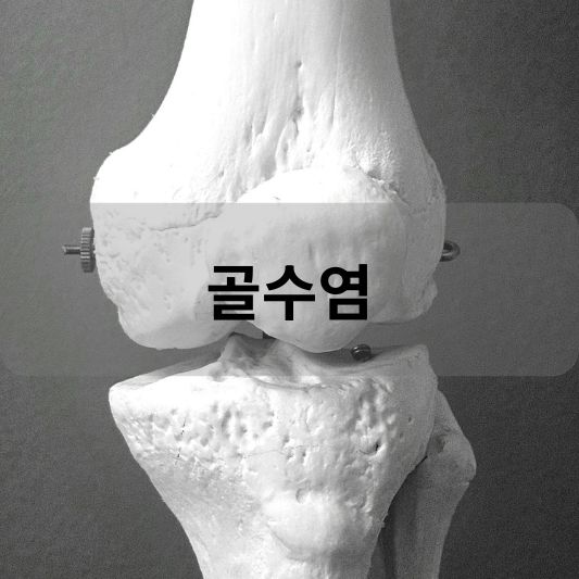 골수염: 원인, 증상, 치료 방법 알아보기!
