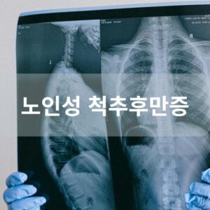 노인성 척추후만증