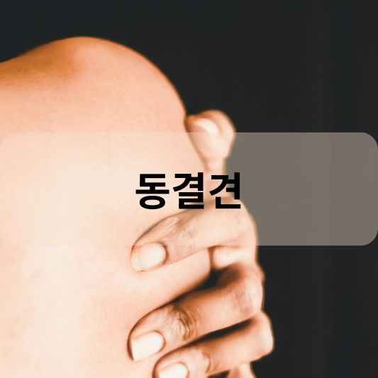 동결견: 원인, 증상, 치료 방법 알아보기!_오십견