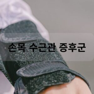 손목 수근관 증후군