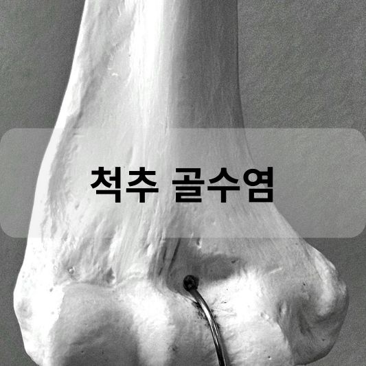 척추 골수염: 원인, 증상, 치료 방법 알아보기!