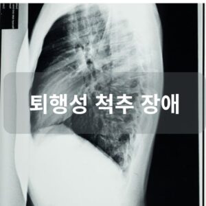 퇴행성 척추 장애