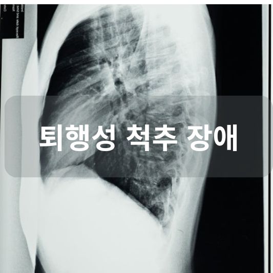퇴행성 척추 장애: 원인, 증상, 치료 방법 알아보기!