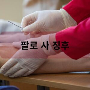 팔로 사 징후