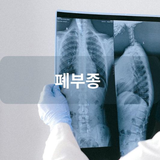 폐부종: 원인, 증상, 치료 방법 알아보기!