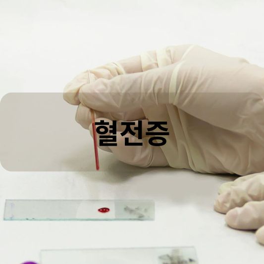 혈전증: 원인, 증상, 치료 방법 알아보기!