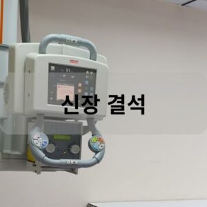 신장 결석