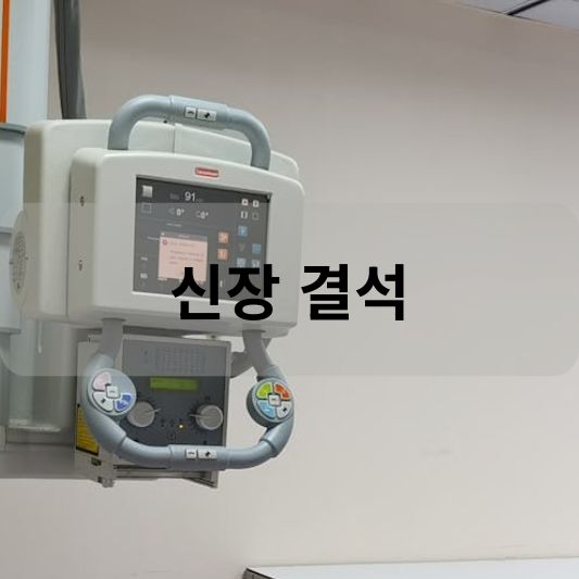 신장 결석: 원인, 증상, 치료 방법 알아보기!