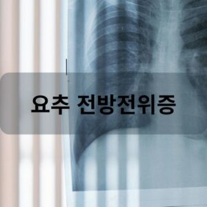 요추 전방전위증