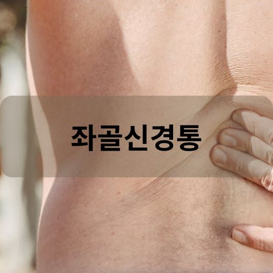 좌골신경통: 원인, 증상, 치료 방법 알아보기!