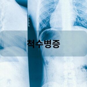 척수병증