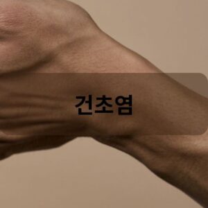 건초염