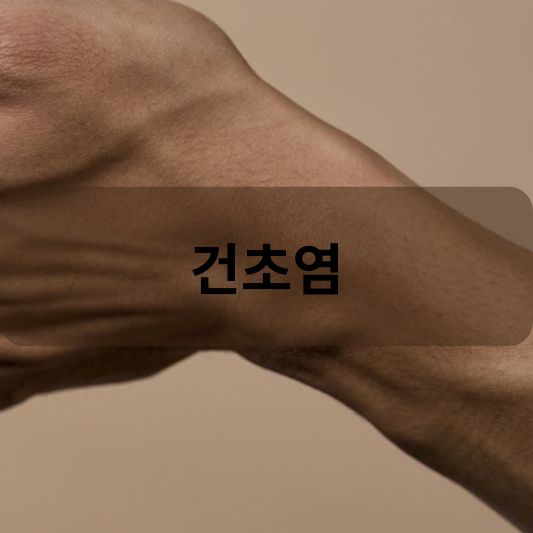 건초염: 원인, 증상, 치료 방법 알아보기!