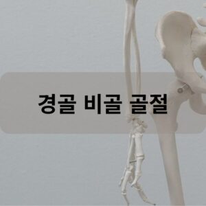 경골 비골 골절